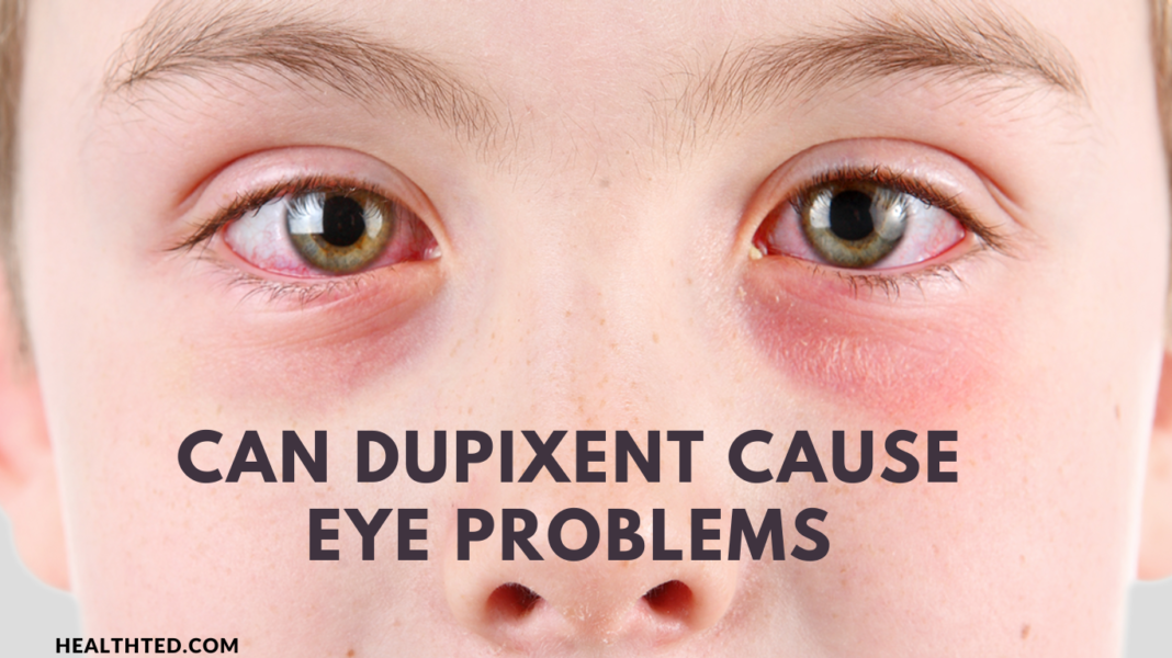 Dupixent Cause Eye Problems