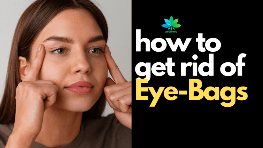 how to get rid of Eye-Bags