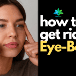how to get rid of Eye-Bags