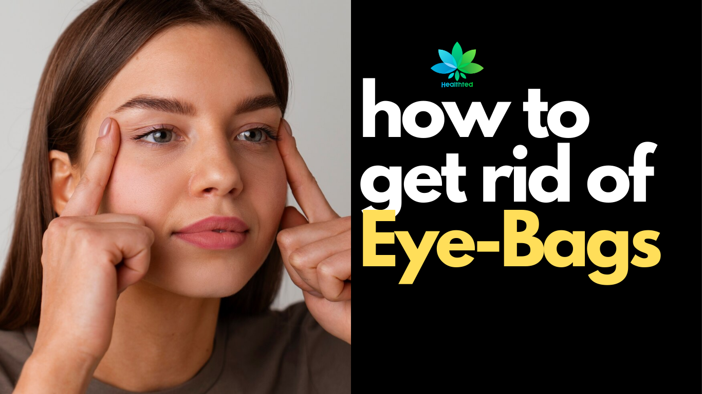 how to get rid of Eye-Bags