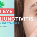 pink eye causes and treatments