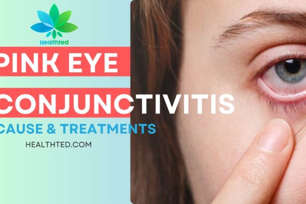 pink eye causes and treatments